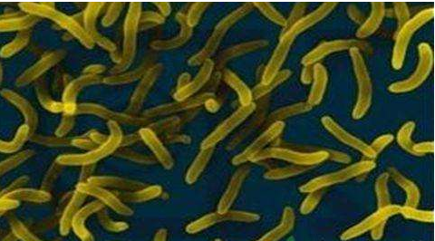 微生物菌劑好？好在哪里您知道嗎？